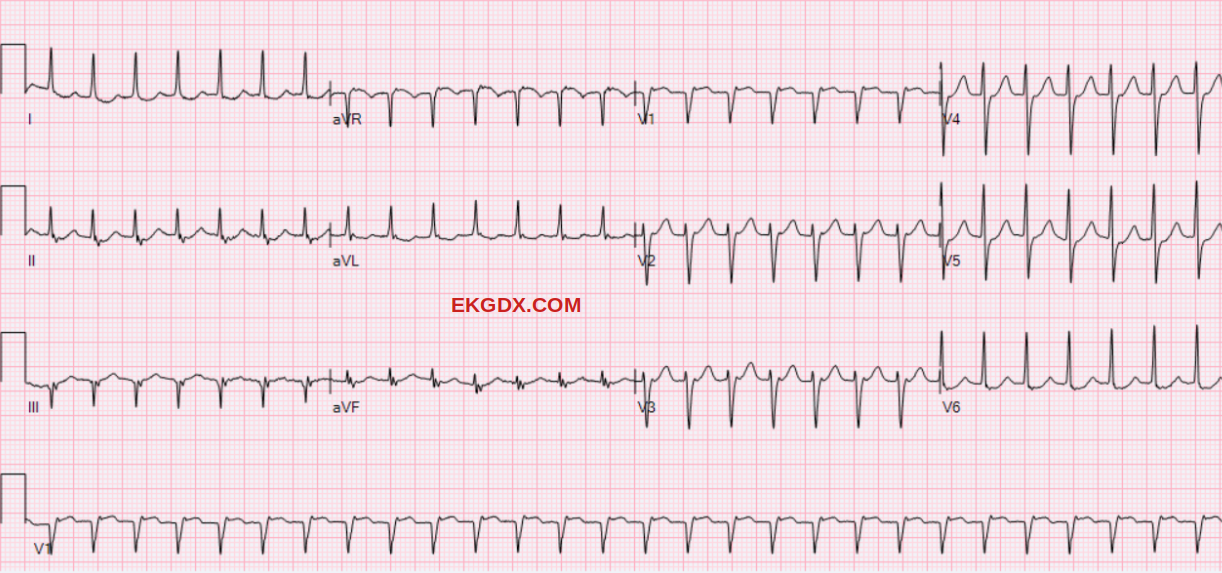 EKGDX - The new era of EKG learning